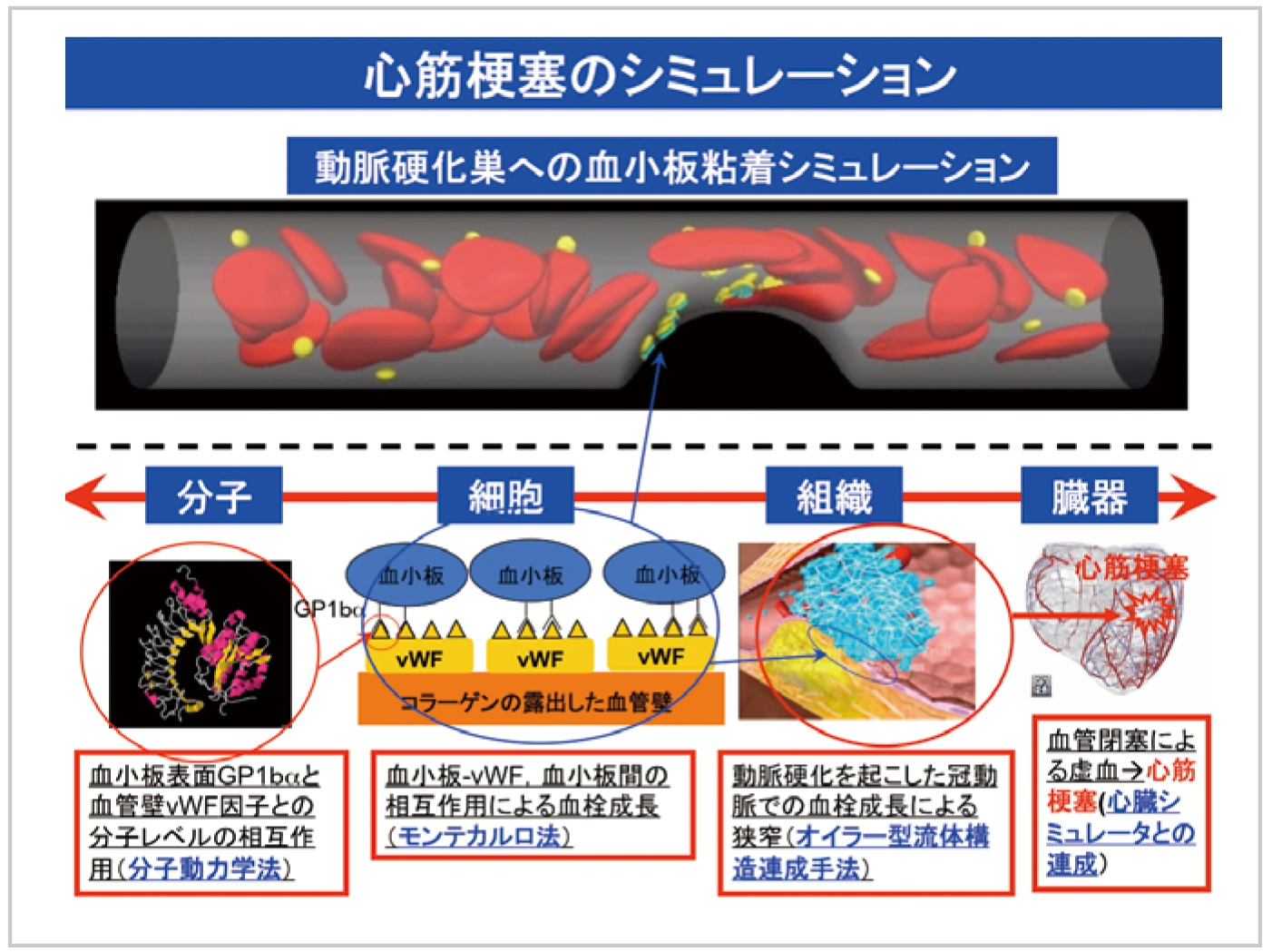 心筋梗塞シミュレーション