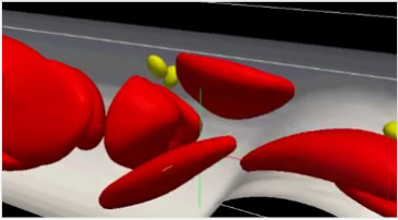 Hierarchical integrated simulation for predictive medicine