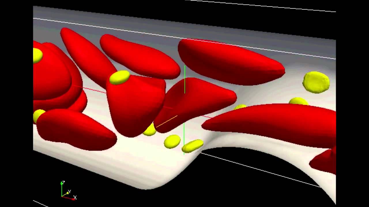 動脈硬化巣への血小板粘着のシミュレーション